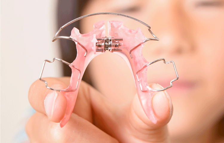 口臭の分析・原因の究明